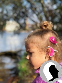 CI Kopf 2018 weiblich Kind